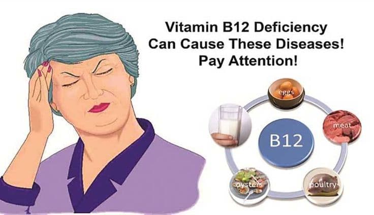 B12