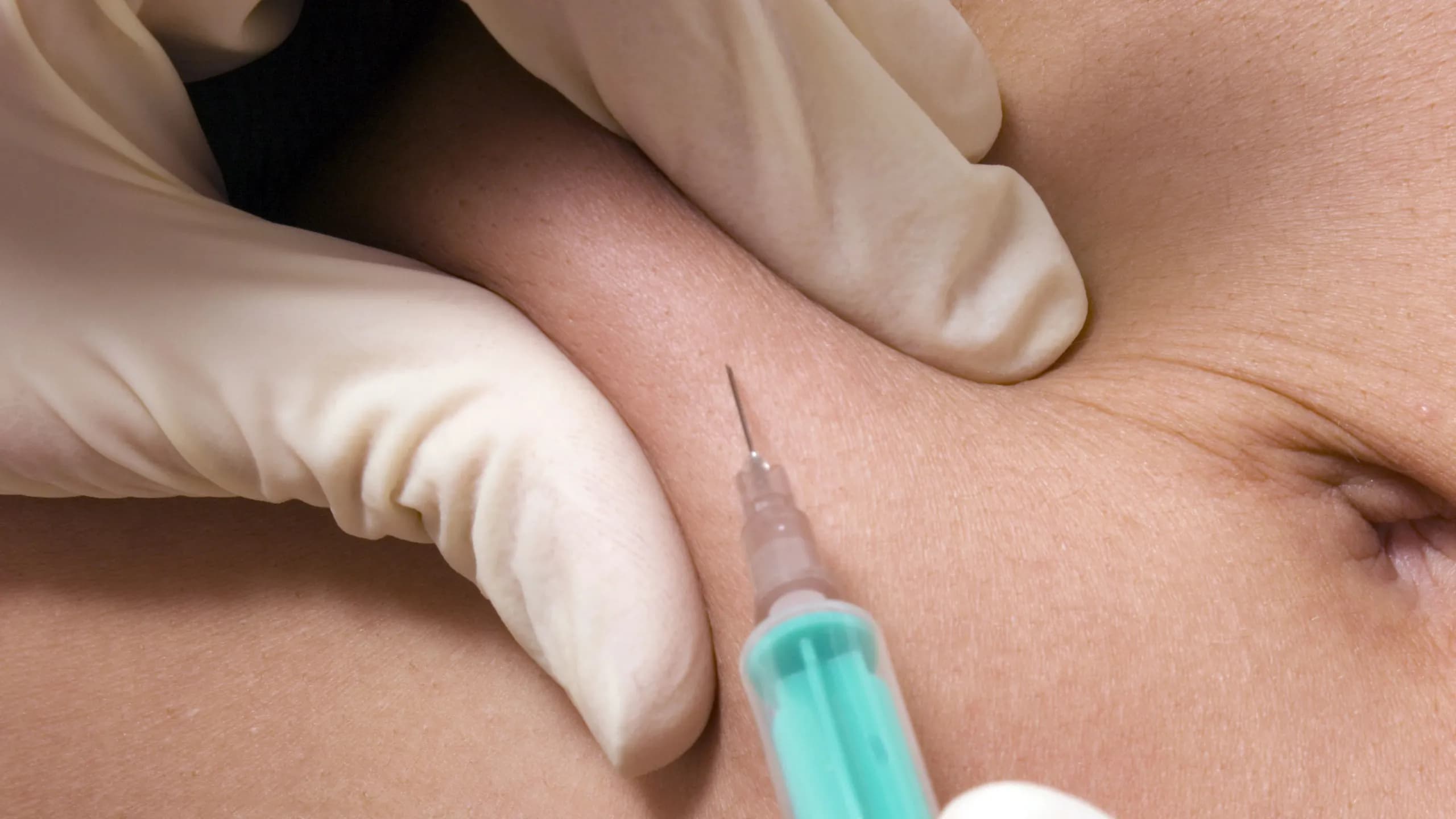 Weight Loss Injection 