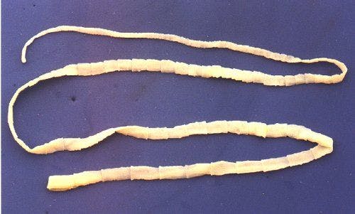 3. The Tapeworm