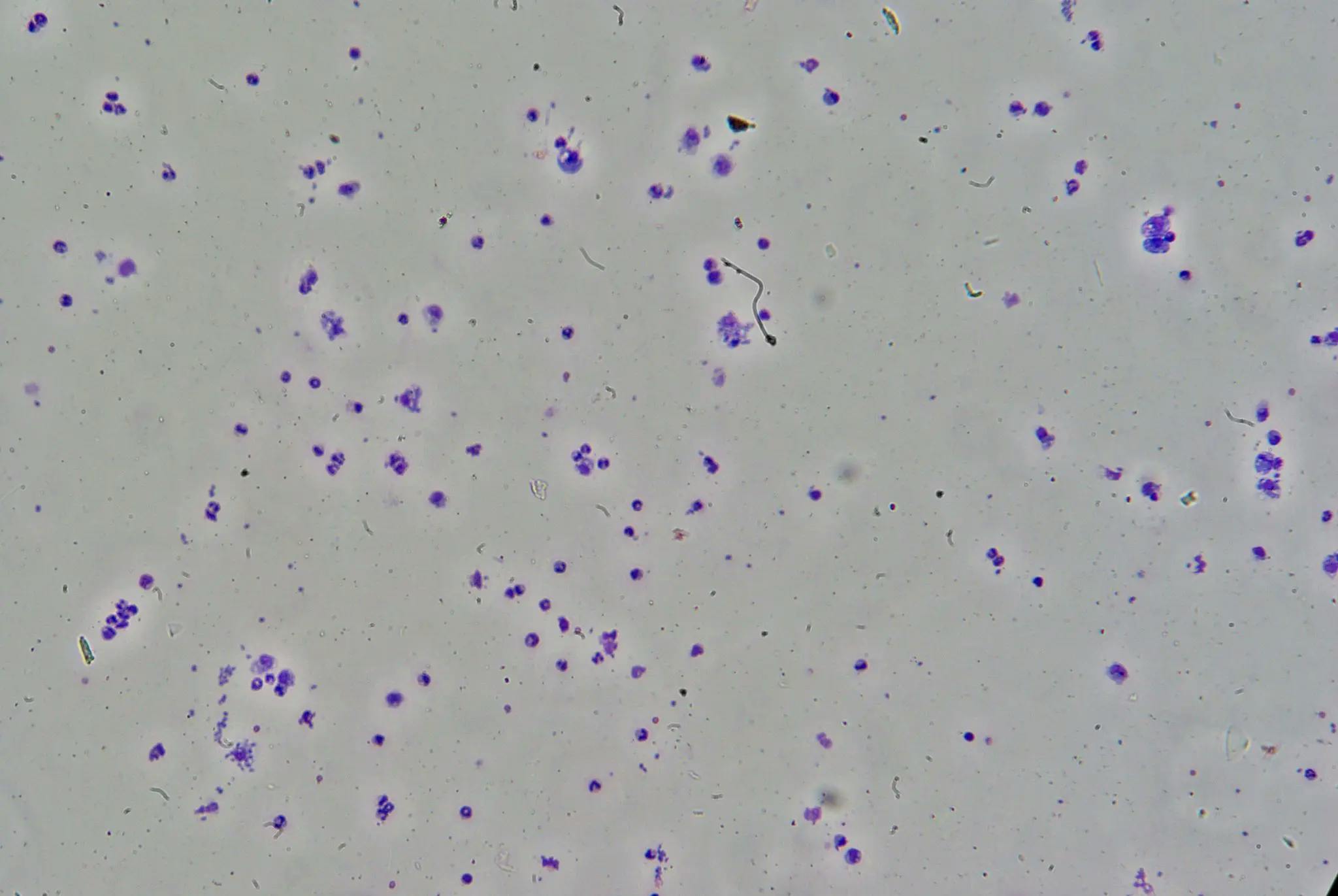 4. Toxoplasma Gondii