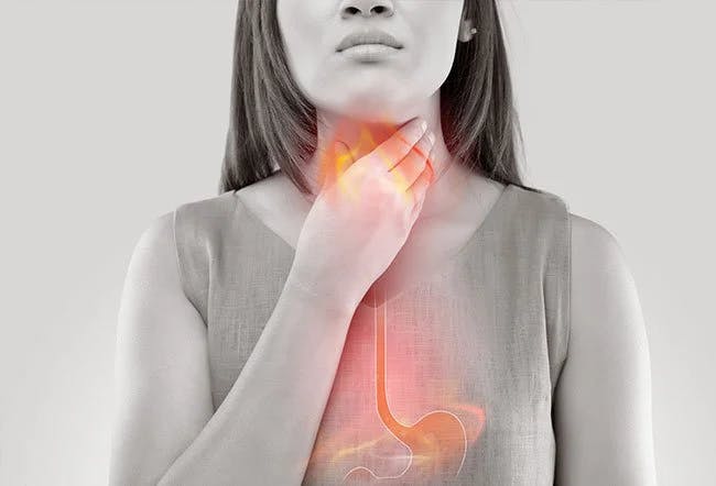 How Can You Tell Whether Your Heartburn 