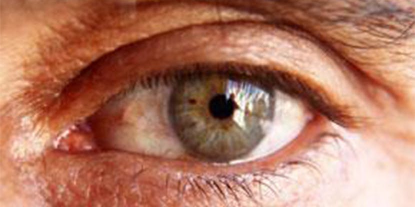 Macular Degeneration Could Be Avoided