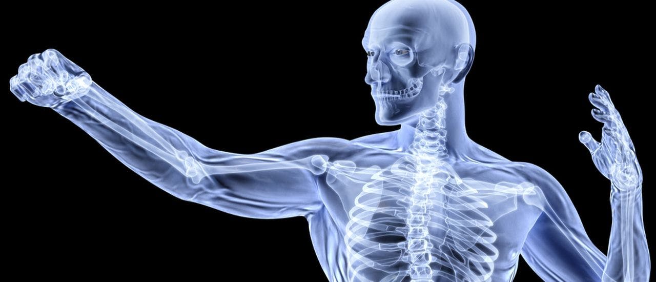The health of The Bones