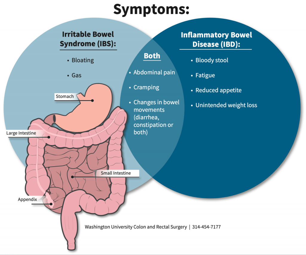 irritable bowel syndrome