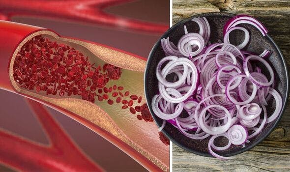 onions can lower levels of cholesterol