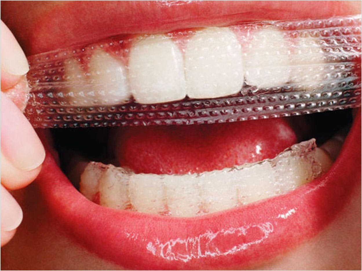 whitening teeth strip 